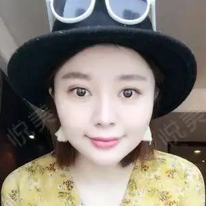 作为一个爱自拍的宝宝,看着自己的照片赶脚把自己都惊...紧致提升悦美整形