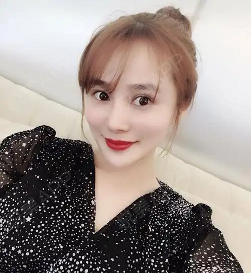 都说现在的美女大部分是整出来的,哈哈我觉得没什么...填充塑形悦美整形