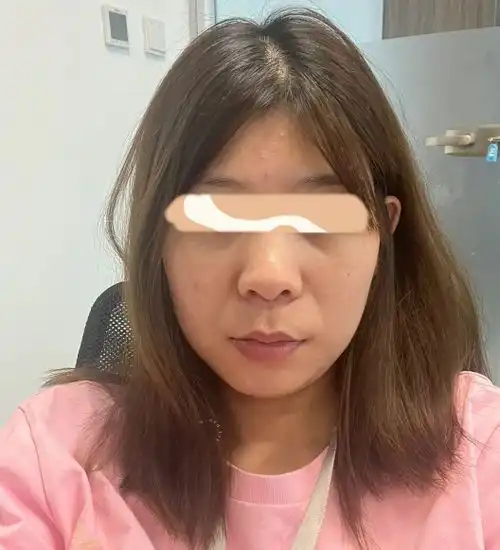 30岁普通女生如何低成本延缓衰老