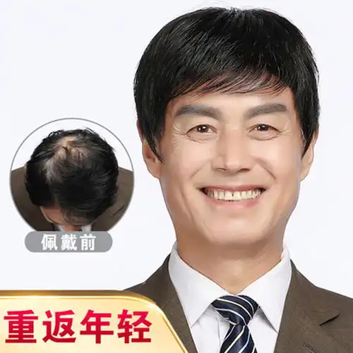 人到中年脱发怎么办
