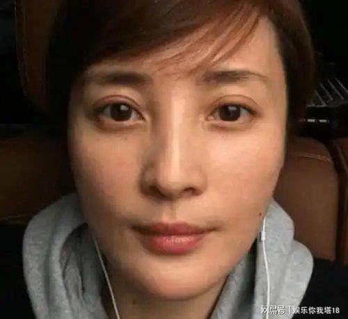 蒋勤勤放出这组照片,我真佩服她的勇气
