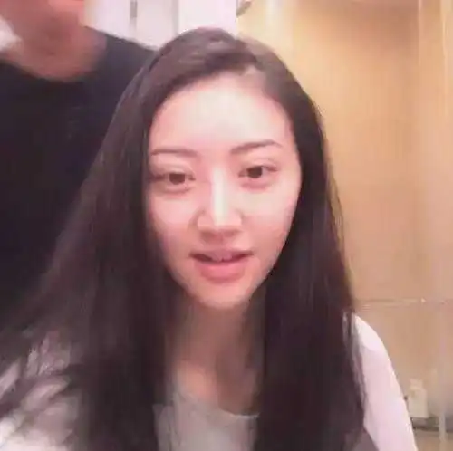 景甜这么有钱双眼皮还是割失败了,可见整容还是看...