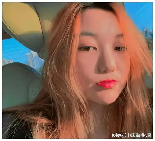 李嫣兔唇并未修复专家一句话撕下王菲遮羞布,原来我们都被骗了