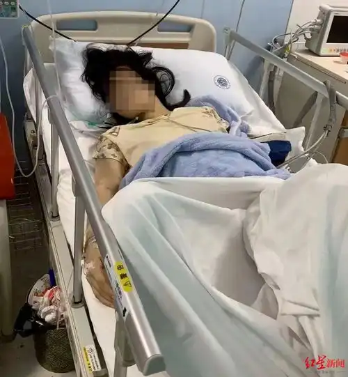 四川遂宁17岁女生突患白血病,急需ab型血小板亲属求助每天都需两人捐献