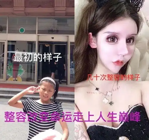 16岁少女整容60次成功做网红,脸部投资过百万,换来更多嘲笑声