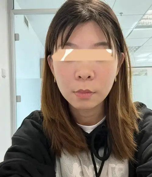 30岁普通女生如何低成本延缓衰老