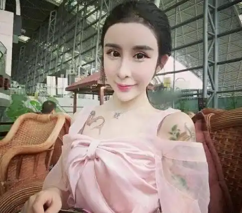 16岁少女花费400万整容200次,如今连走路都艰辛,后悔也来不及了