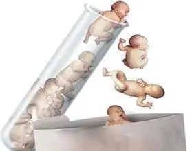 男人对试管婴儿的无知,导致试管失败