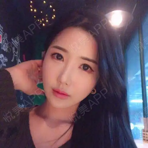 前两天去做了第二次复查,男朋友陪我一起去的,在做手...磨骨悦美整形