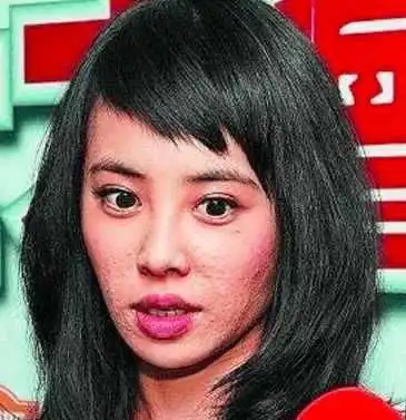 林心如baby张馨予长痘拉低颜值,蔡依林脸上这痘印太厚实了