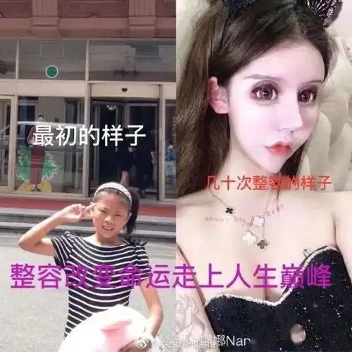 我花了100万,把女儿整成了残废暑假整容风潮后,有20万女孩正在消失