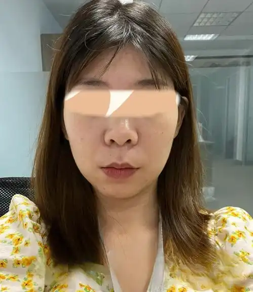30岁普通女生如何低成本延缓衰老