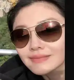 林允说她每个月都要做的医美,真的这么神奇