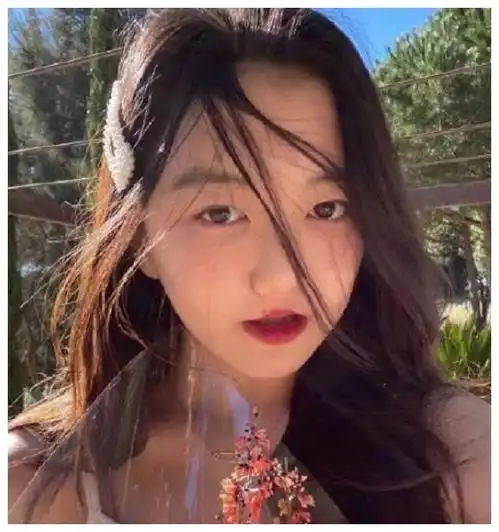 14岁的李嫣,撕掉兔唇标签后曾被指炫富,如今现状用实力打脸