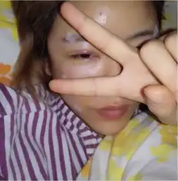 20岁苗条少女已经整容失败被毁容,不料天算不如人算