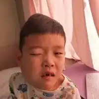 滦州九百户镇这个可怜的小男孩,才7岁就得了这种病,请伸出援助之手