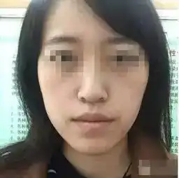 众康医美自体脂肪是个好东西,用好了大妈也能变少女