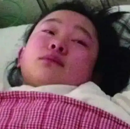 女大学生胃癌晚期,胃硬如皮革,医生这三种食物害了不少人不听劝想早死就继续吃