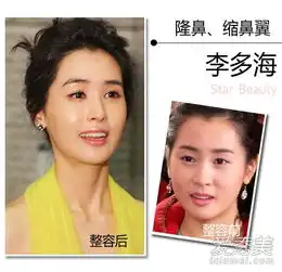 韩女星整容前旧照曝光崔智友眼小鼻塌