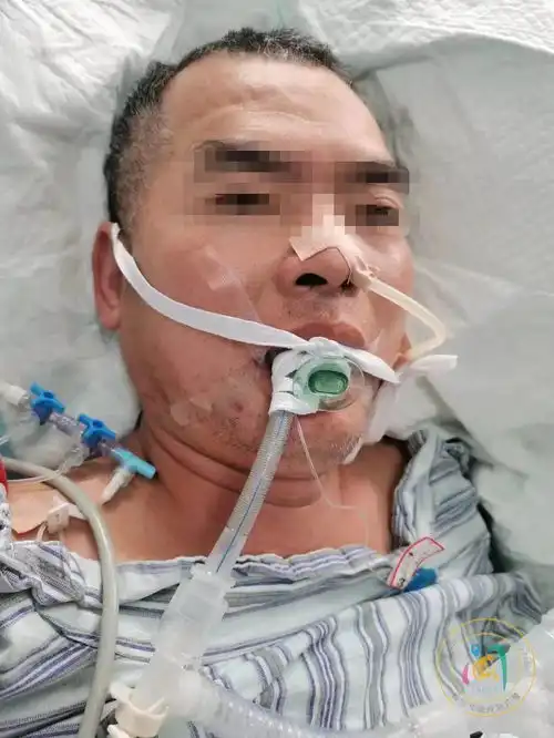 小心福建男子路过草丛,却碰到了这东西