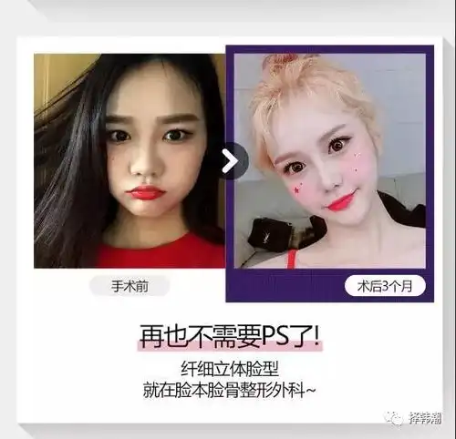 有图有真相,看看韩国男女整容真人案例