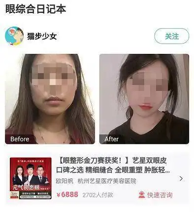 更美app签到活动遭用户集中投诉医美案例分享者性别忽男忽女真实性存疑