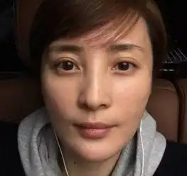 欢乐颂2收尾刘涛却长了痘舒淇蒋勤勤齐支招击退痘痘赶走敏感